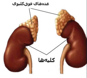 یکعلت فشار خون بالا که معمولا پزشکان نادیده میگیرند