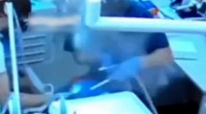 لحظه هولناک انفجار دستگاه دندانپزشکی در دهان بیمار