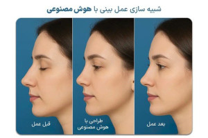 شبیهسازی عمل بینی با هوش مصنوعی