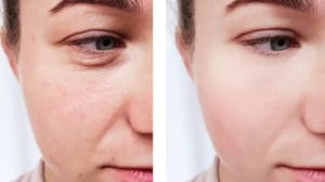 میوه پرطرفداری که پوست صورت را جوان نگه میدارد