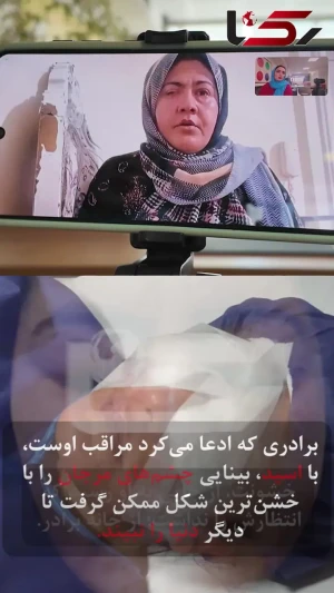 برادر در چشمان خواهر اسید ریخت تا سر کار نرود!/ این زن به کمک ما نیاز دارد + فیلم