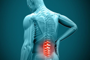 این عوامل باعث ابتلای شما به دیسک کمر میشوند