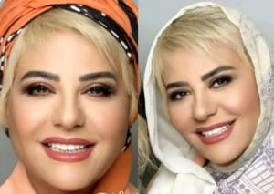 بیوگرافی رابعه اسکویی در ۵۹ سالگی + تغییرچهره و جوان تر شدن شوکه کننده