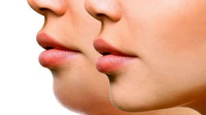 چگونه غبغب خود را کوچک کنیم؟ راهکارهای موثر