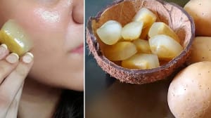 بوتاکس طبیعی با یخ سیب زمینی؛ راز جوانی بدون سوزن!